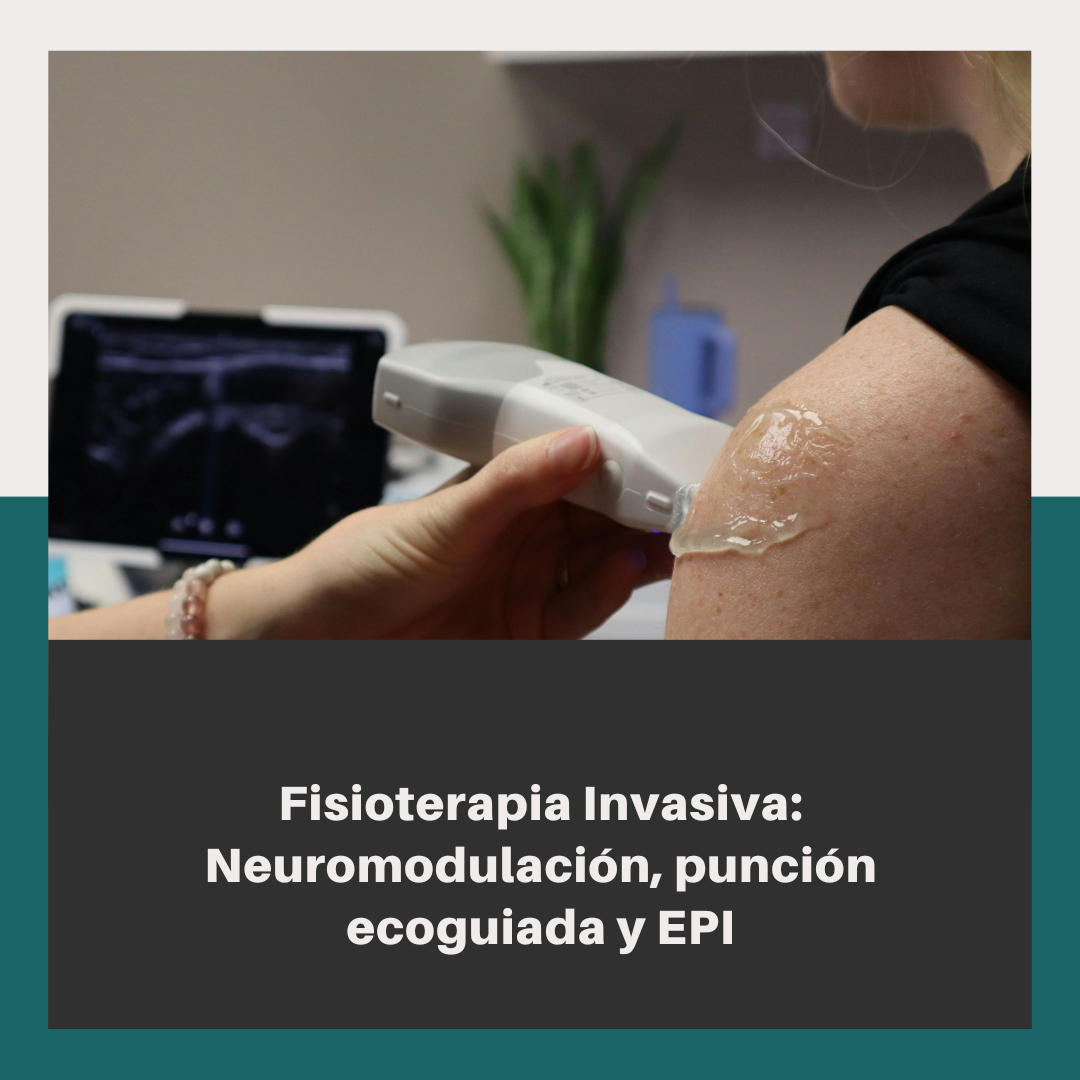 Fisioterapia invasiva